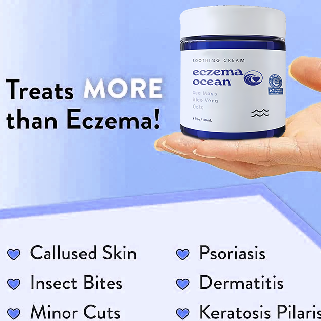 EczemaOcean® Eczema Relief Cream