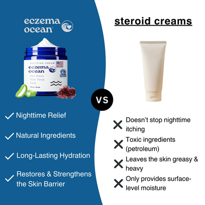 EczemaOcean® Eczema Relief Cream