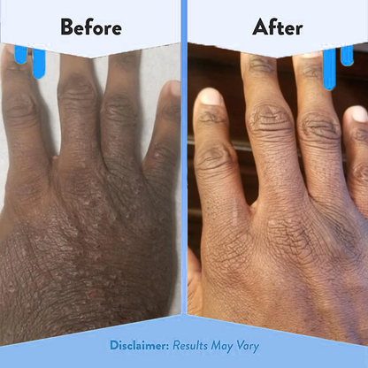 EczemaOcean® Eczema Relief Cream